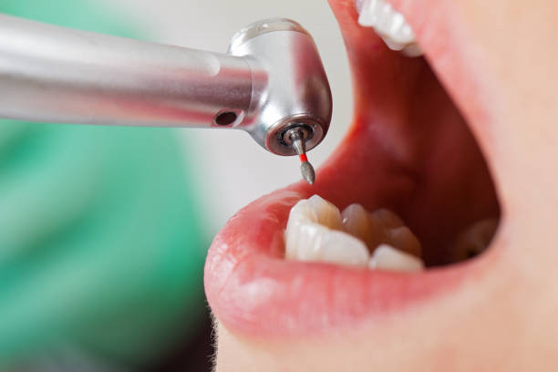 Best Mobile Emergency Dentist in Chadbourn, NC